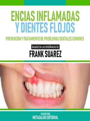 cover image of Encias Inflamadas Y Dientes Flojos--Basado En Las Enseñanzas De Frank Suarez